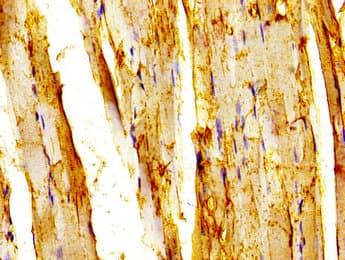 Polyclonal Rabbit anti-Human TRAF7 Antibody (IHC)