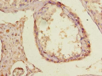 TTC30B Antibody