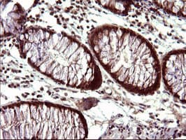 UPRT Antibody (clone OTI2D1)
