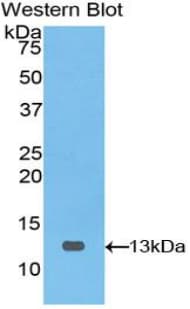 PIGR Antibody (aa461-560)