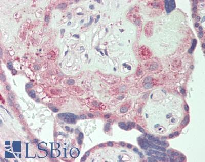 CSF1R / CD115 / FMS Antibody (aa768-928)