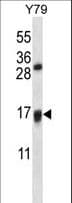 VKORC1L1 Antibody (aa19-47)