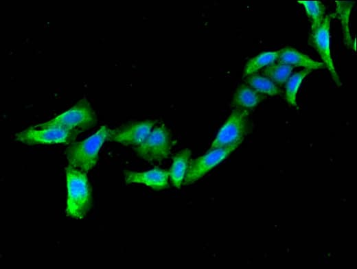 KCNJ3 / GIRK1 Antibody