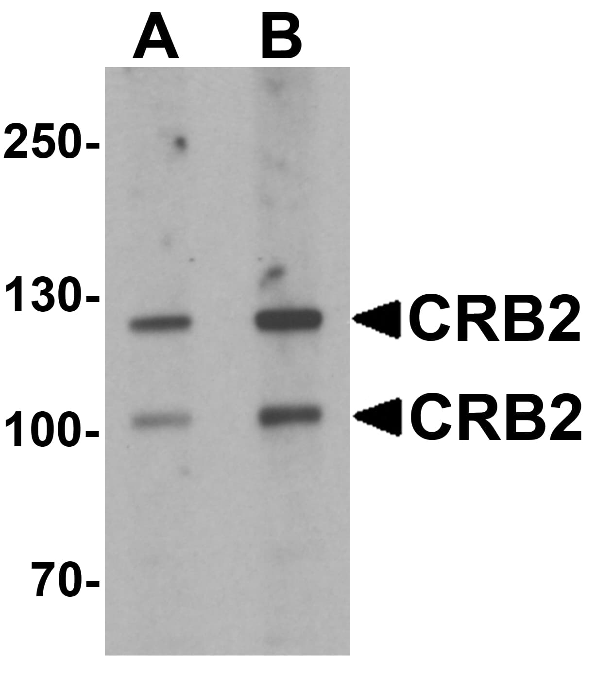 CRB2 Antibody