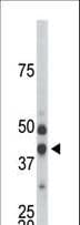 CDKL1 Antibody (aa285-316)