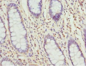 Polyclonal Rabbit anti-Human TAGLN2 / Transgelin 2 Antibody (IHC, WB)