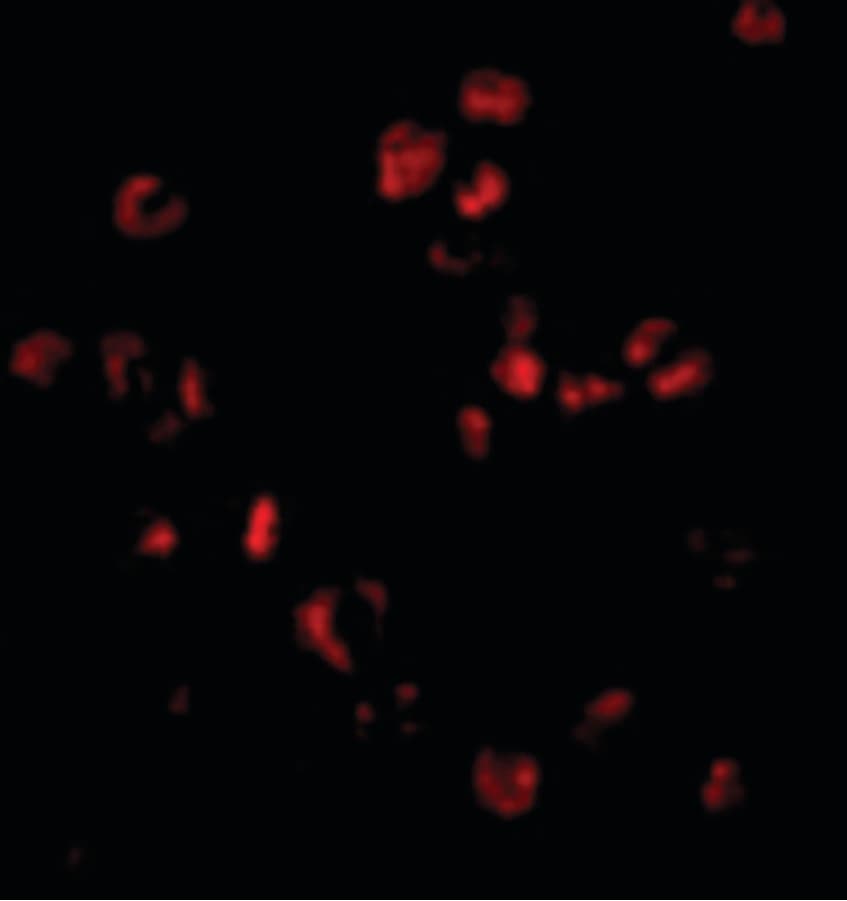 IHC-plus™ SUMO1 / SMT3 Antibody