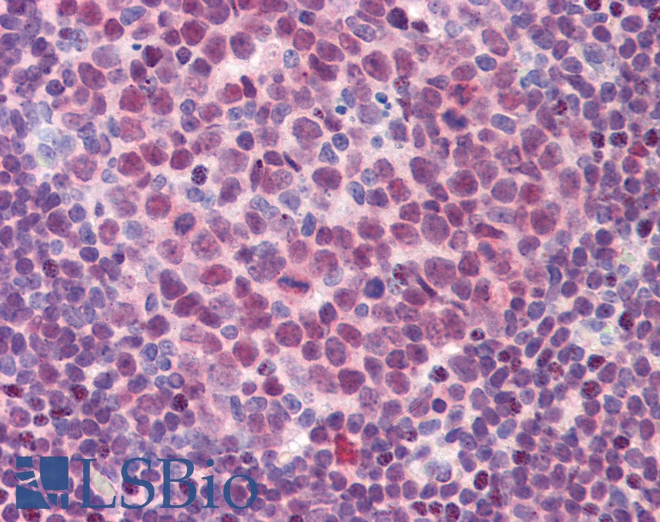 IHC-plus™ SPI1 / PU.1 Antibody (aa27-37)