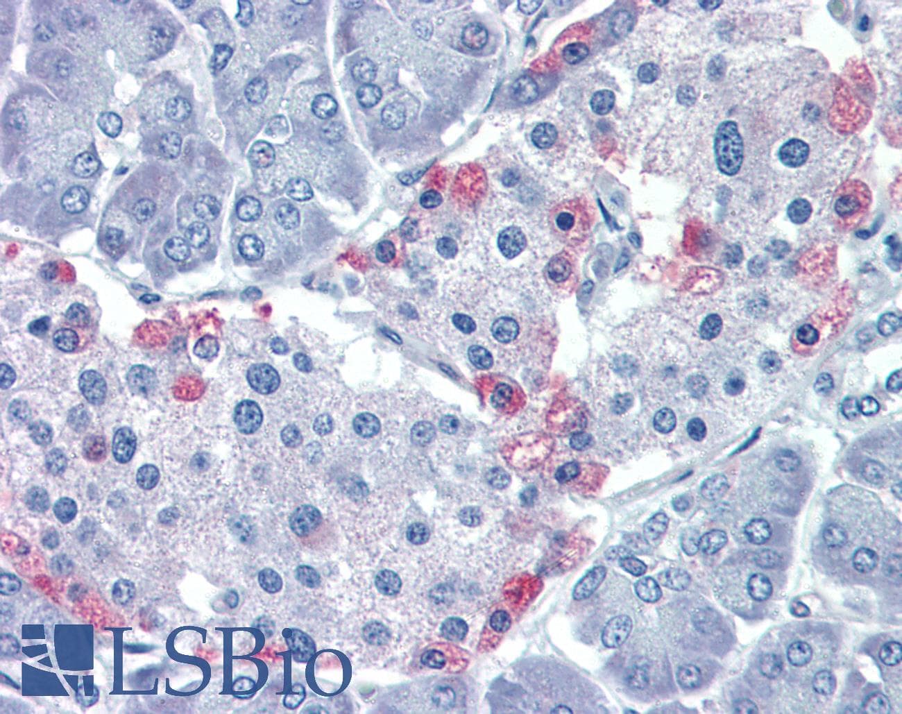 IHC-plus™ PDK4 Antibody (aa382-410)