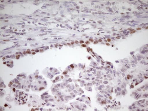 Monoclonal Mouse anti-Human SP110 Antibody (clone OTI4C1, Carrier-free, aa232-521, IHC, WB)