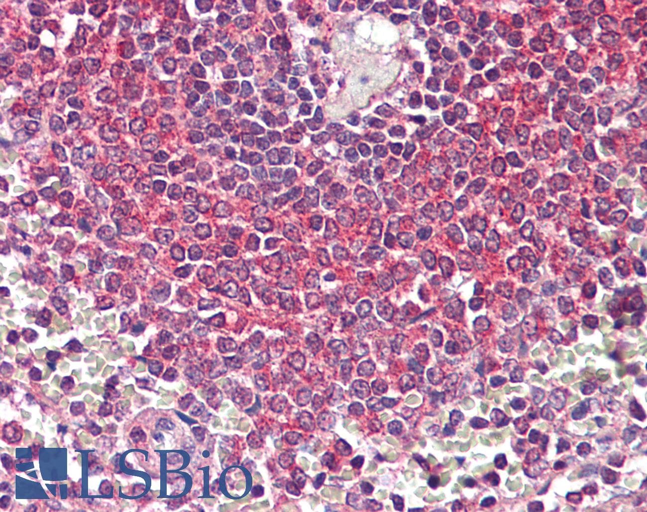 Polyclonal Rabbit anti-Human NFKB1 / NF-Kappa-B Antibody (N-Terminus, IHC, WB)