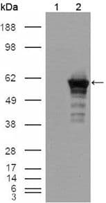 DES / Desmin Antibody (clone 10H7D2)