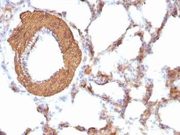 Muscle Actin Antibody (clone HHF35 + MSA/953)
