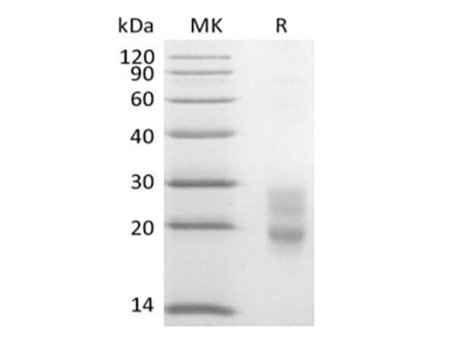 Mouse CD7 Protein (Recombinant 6His, C-terminus)