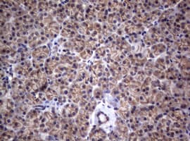 CTNND1 / p120 Catenin Antibody (clone OTI2G7)