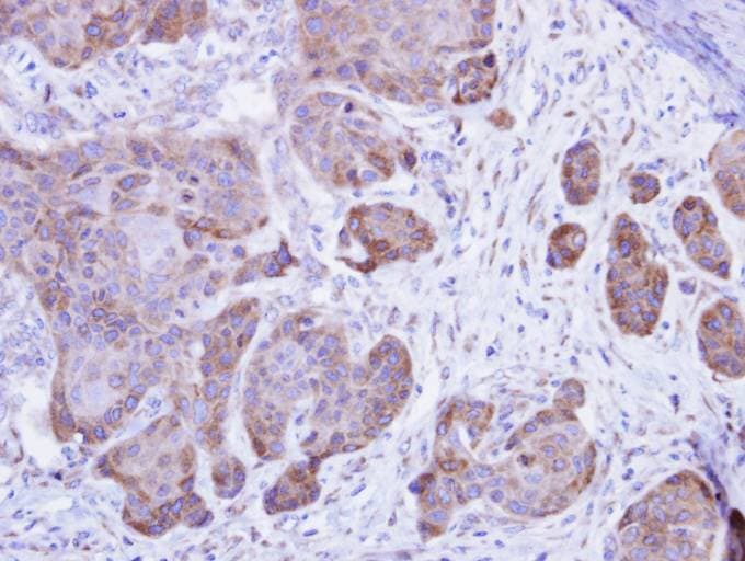 CASQ2 / Calsequestrin 2 Antibody (aa124-388)