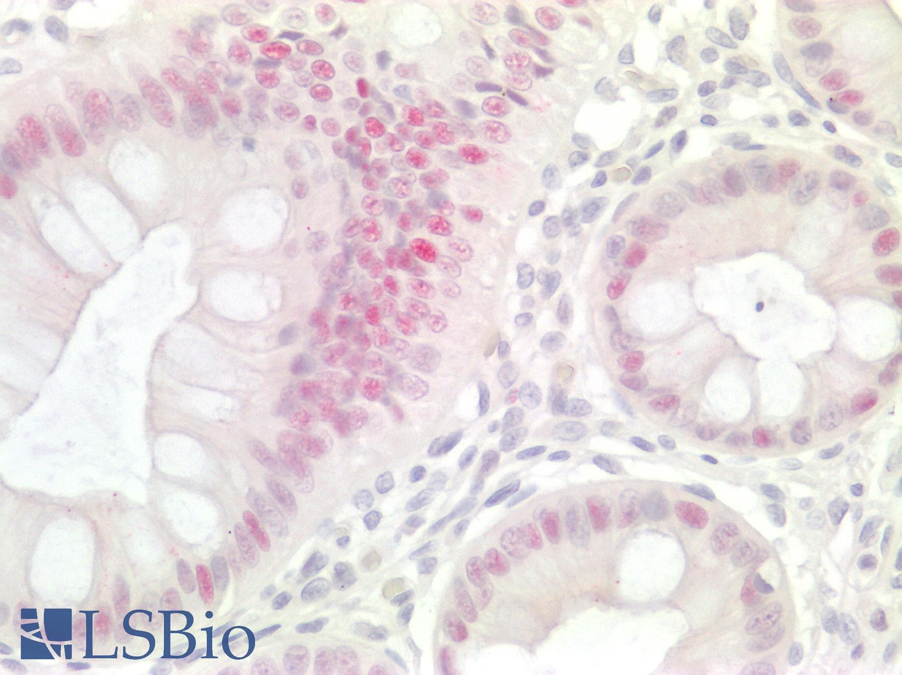 PathPlus™ CDKN1A / WAF1 / p21 Antibody