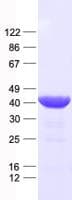 Human DLX2 Protein (Recombinant His, N-Terminal)