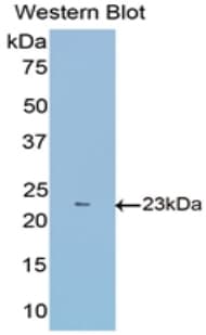 FBLN1 / Fibulin 1 Antibody (aa399-578, APC)