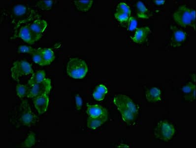 Polyclonal Rabbit anti-Human MLST8 / GBL Antibody (IHC, IF)