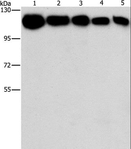 Polyclonal Rabbit anti-Human HK2 / Hexokinase 2 Antibody (IHC, WB)