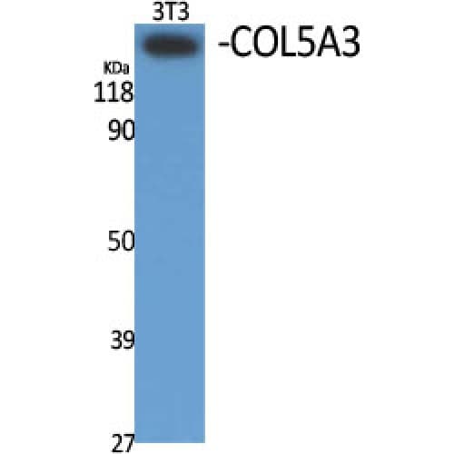 COL5A3 / Collagen V Alpha 3 Antibody (190-270 aa, N-terminal)