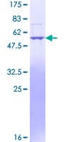 Human Endonuclease G / ENDOG Protein (Recombinant GST)