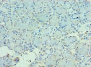 Polyclonal Rabbit anti-Human MTM1 / Myotubularin Antibody (aa484-603, IHC)