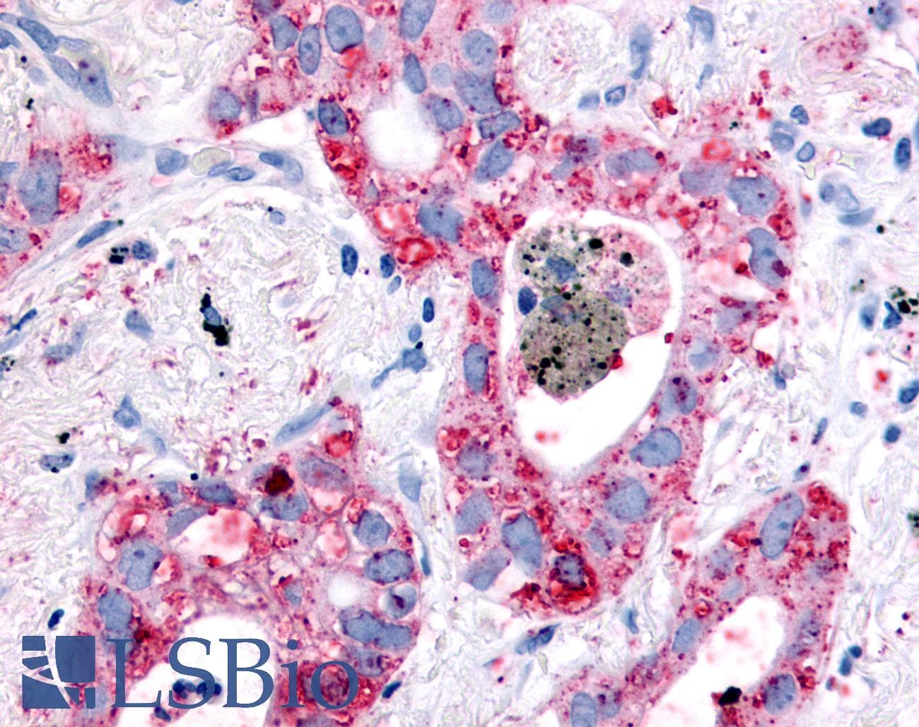 PathPlus™ Polyclonal Rabbit anti-Human EGFR Antibody (C-Terminus, IHC)