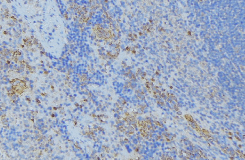 CDA / Cytidine Deaminase Antibody