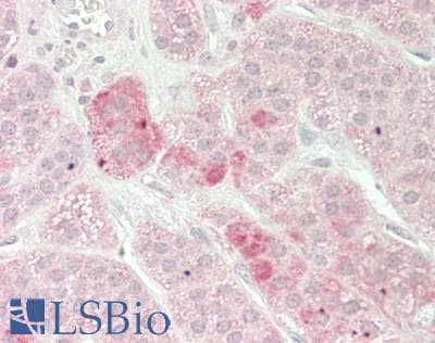 IHC-plus™ SCAMP3 Antibody (aa2-170)