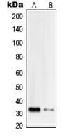 PITPNB Antibody (Internal)