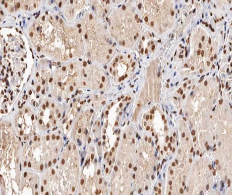 Polyclonal Rabbit anti-Human TP53 / p53 Antibody (phospho-Ser315, IHC, IF, WB)