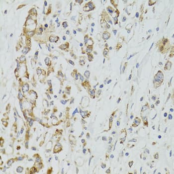 Polyclonal Rabbit anti-Human DICER1 / Dicer Antibody (IHC, WB)