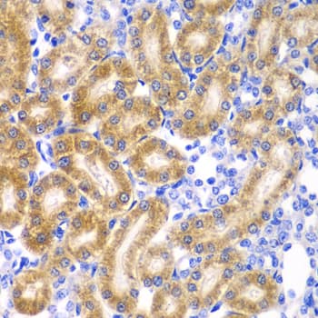 RPN1 / Ribophorin I Antibody