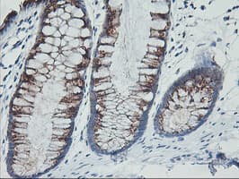 GOLM1 / GP73 / GOLPH2 Antibody (clone OTI4B3, Carrier-free)