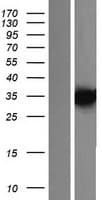 KCTD7 Protein (Over-Expression Lysate Myc-DDK (Flag))