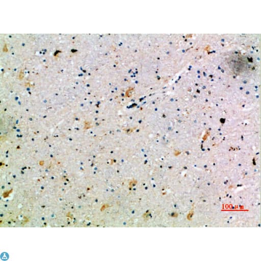 CCL14 Antibody