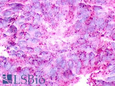 PathPlus™ GPCRW / GPR18 Antibody (Extracellular Domain)