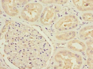 Polyclonal Rabbit anti-Human FTHFSDC1 / MTHFD1L Antibody (IHC, WB)