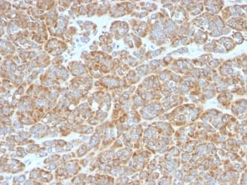 BCL2 / Bcl-2 Antibody (clone BCL2/796)