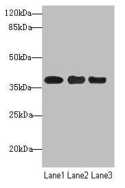 Polyclonal Rabbit anti-Human UBE2Z / USE1 Antibody (IHC, WB)