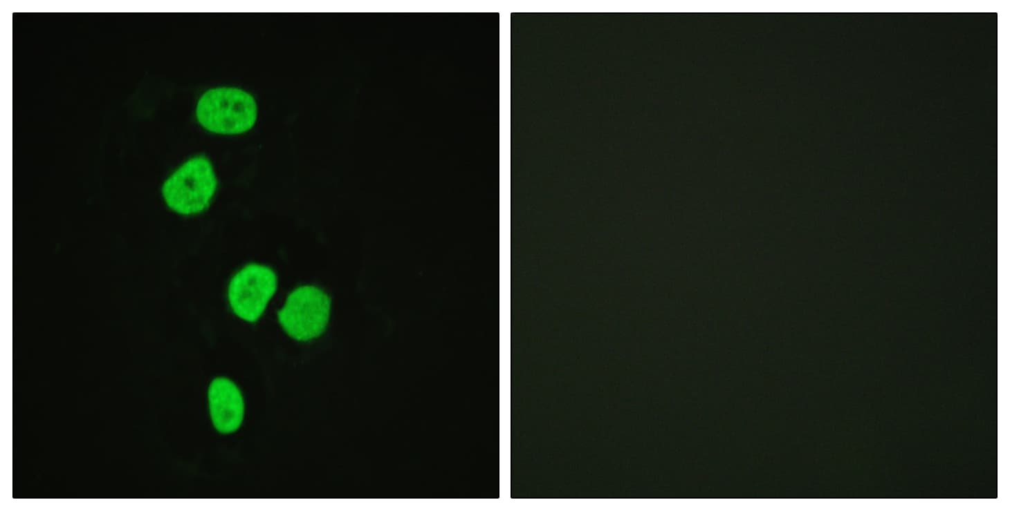 TBC1D4 / AS160 Antibody (aa611-660)