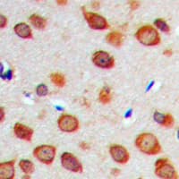 Polyclonal Rabbit anti-Human NOTCH1 Antibody (Internal, IHC, IF, WB)
