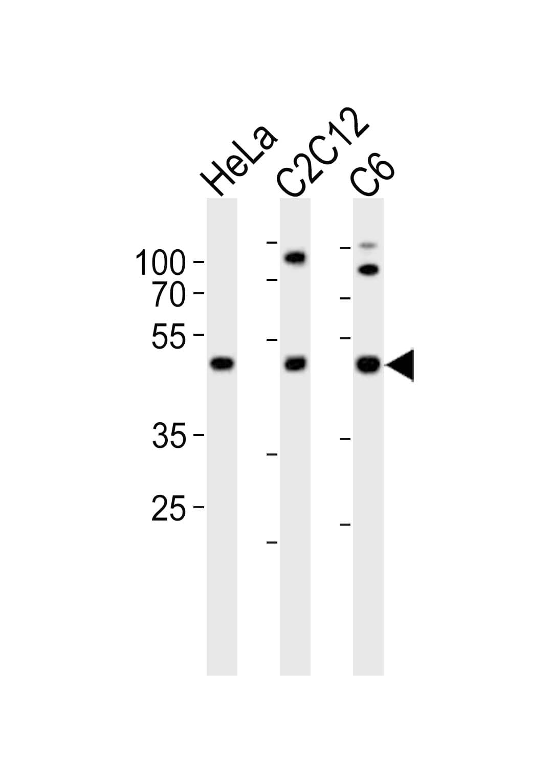 Polyclonal Rabbit anti-Human PAFAH1B1 / LIS1 Antibody (aa76-110, WB)