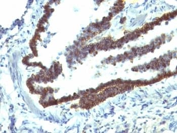 EPCAM Antibody (Cytoplasmic Domain, clone EGP40/1110, Ready-to-Use)
