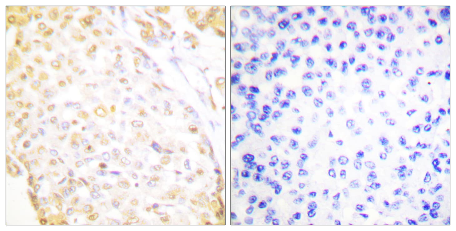 Polyclonal Rabbit anti-Human NKX3-1 Antibody (aa1-50, IHC)