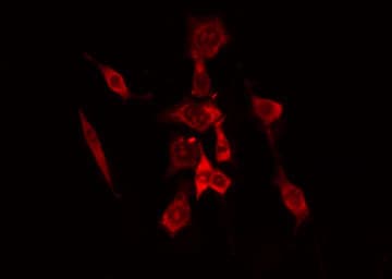 TUBGCP6 / GCP6 Antibody