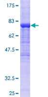 Human ALDH1A1 / ALDH1 Protein (Recombinant GST)
