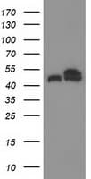TUBB4 / Tubulin Beta 4 Antibody (clone OTI3F1, Carrier-free)